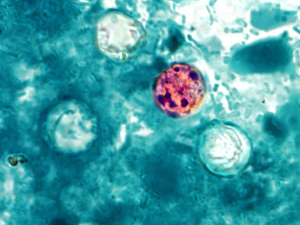 CDC, FDA link Taco Bell lettuce supplier to multistate cyclosporiasis outbreak