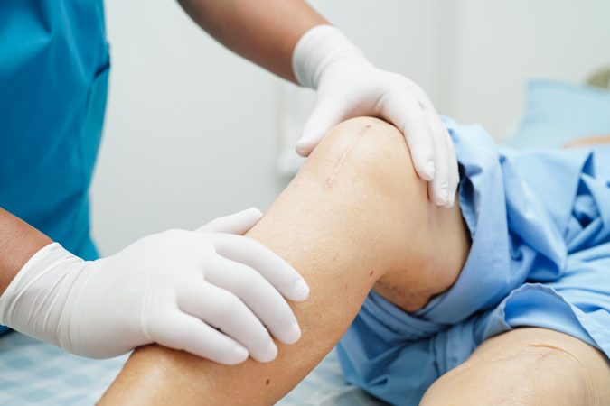 Knee pain? Ragged cartilage? Research suggests surgery’s not the best answer