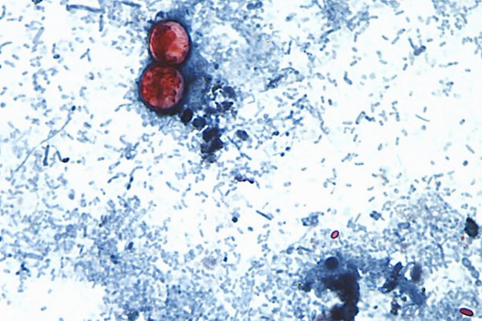 CDC expands largest known cyclospora outbreak to 15 states