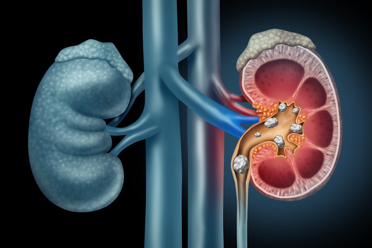 Her back hurt, then she couldn’t button her pants. The cause was alarming. | Medical Mystery