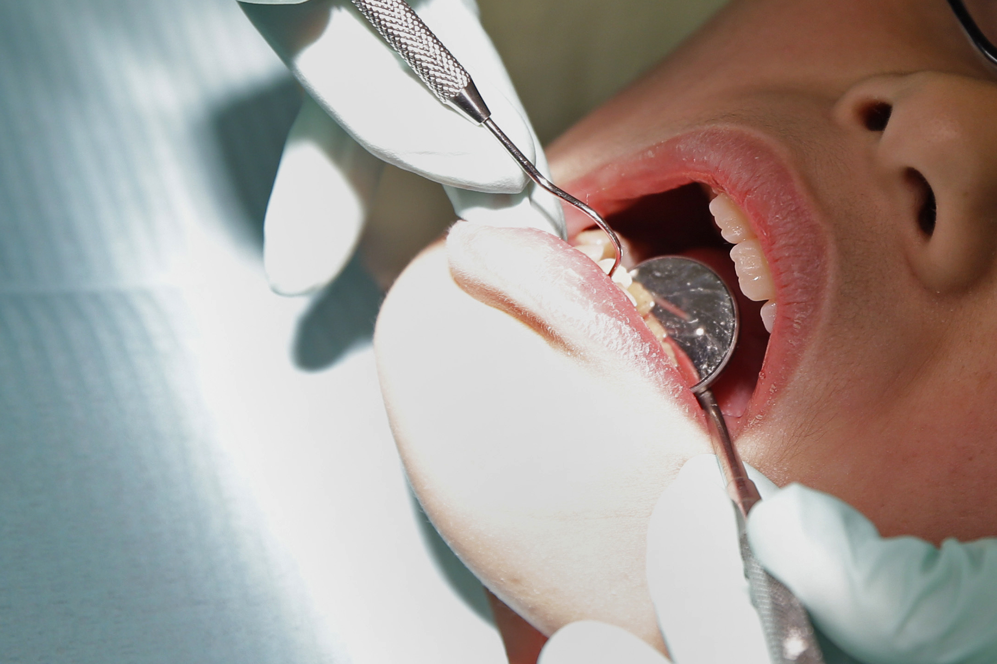 5 subtle dental symptoms you should never ignore