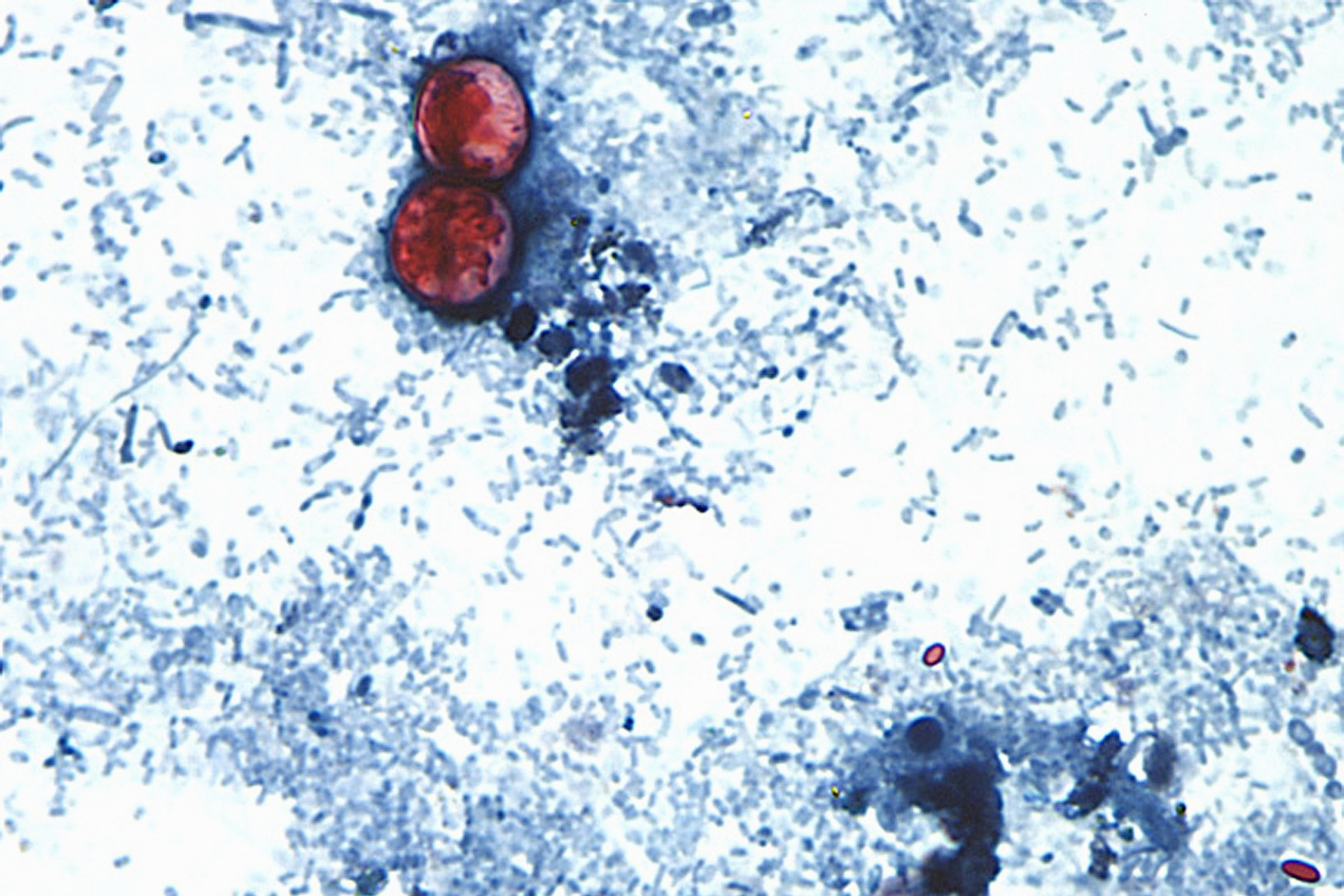 US officials declare an end to record-setting cyclospora outbreak, but its origin is still unknown