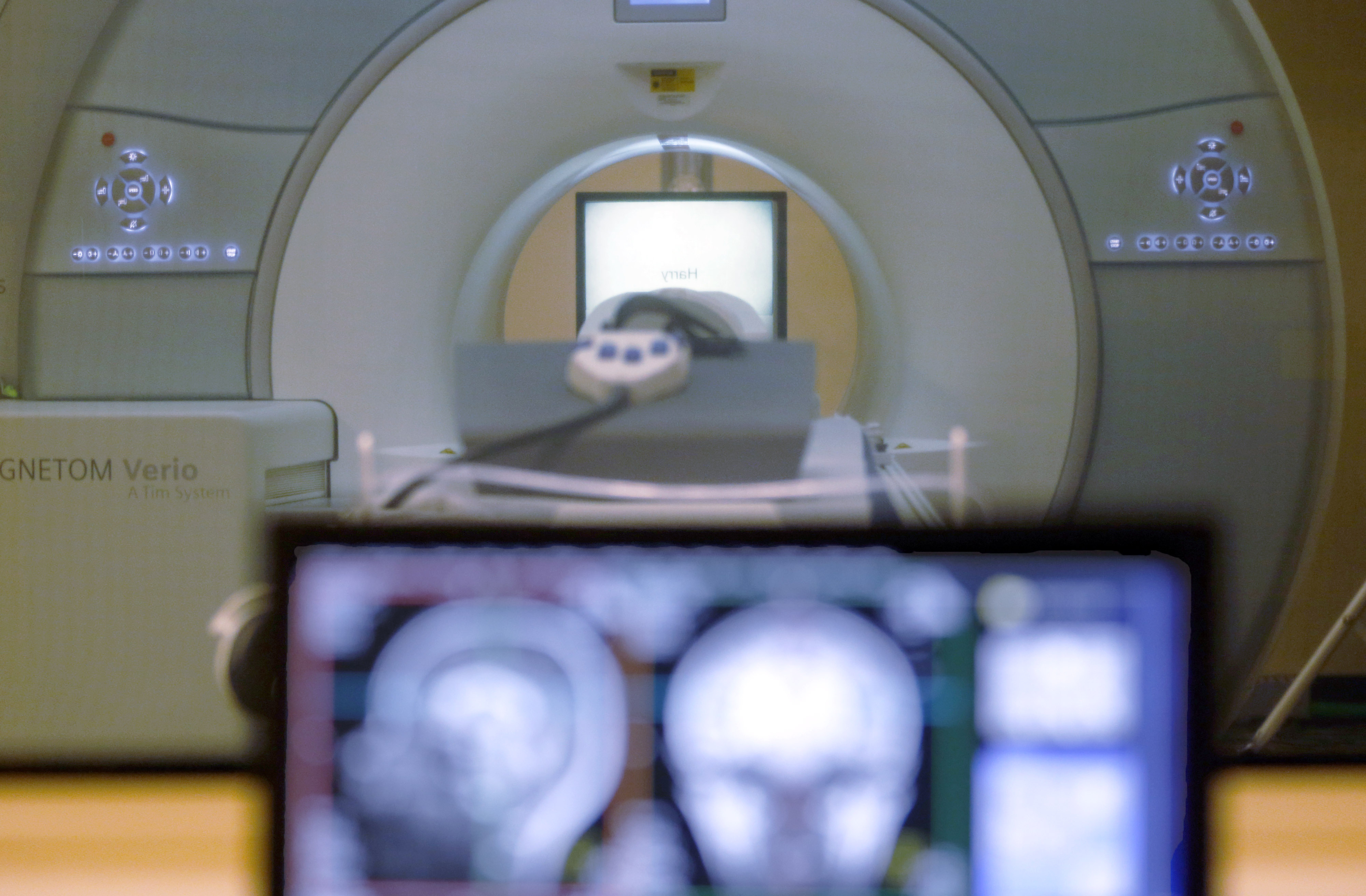 In this collaboration between Penn and the University of Miami, researchers will track 330 carriers who are over the age of 45. The participants will undergo regular cognitive and motor testing, MRI scans, and analyses of body fluids.